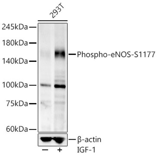 Phospho-eNOS-S1177 Rabbit mAb