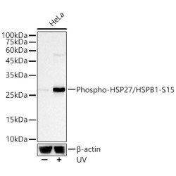 Phospho-HSP27/HSPB1-S15 Rabbit mAb