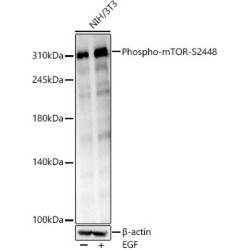 Phospho-mTOR-S2448 Rabbit mAb