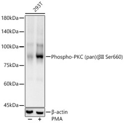 Phospho-PKC (pan) (βII Ser660) Rabbit mAb
