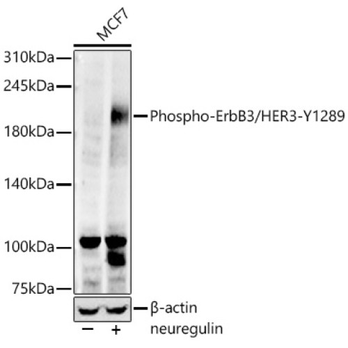 Phospho-ErbB3/HER3-Y1289 Rabbit mAb