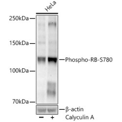 Phospho-RB-S780 Rabbit mAb