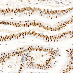 Phospho-CREB1-S133 Rabbit mAb