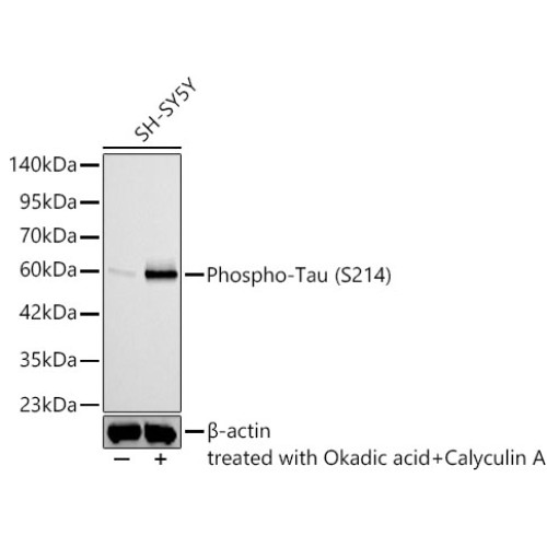Phospho-Tau (S214) Rabbit mAb