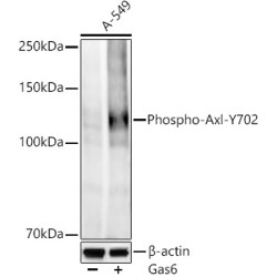 Phospho-Axl-Y702 Rabbit mAb