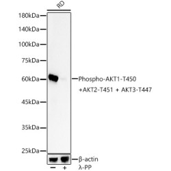 Phospho-AKT1-T450 + AKT2-T451 + AKT3-T447 Rabbit mAb