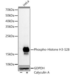 Phospho-Histone H3-S28 Rabbit mAb