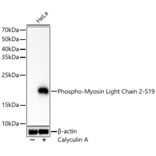 Phospho-Myosin Light Chain 2-S19 Rabbit mAb