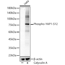Phospho-YAP1-S127 Rabbit mAb