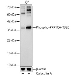 Phospho-PPP1CA-T320 Rabbit mAb