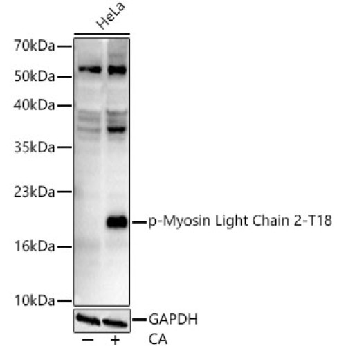 Phospho-Myosin Light Chain 2-T18 Rabbit mAb