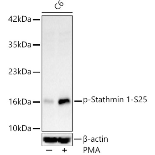 Phospho-Stathmin 1-S25 Rabbit mAb