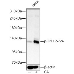 Phospho-IRE1-S724 Rabbit mAb