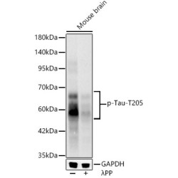 Phospho-Tau-T205 Rabbit mAb