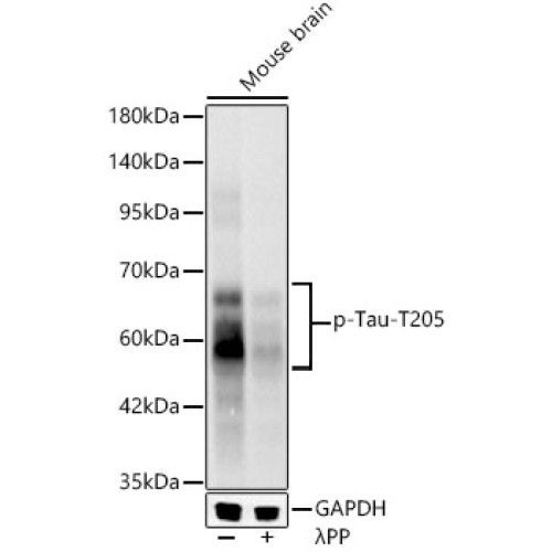Phospho-Tau-T205 Rabbit mAb
