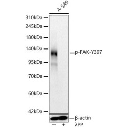 Phospho-FAK-Y397 Rabbit mAb