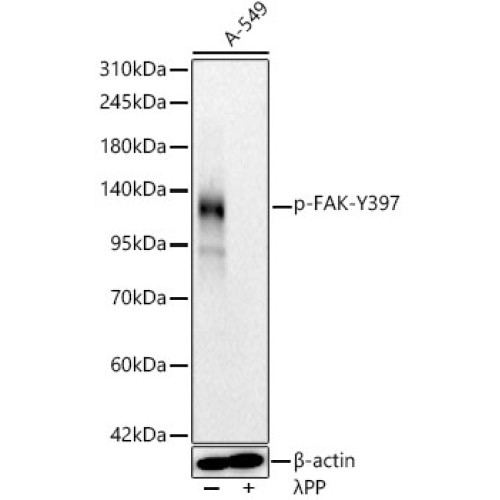 Phospho-FAK-Y397 Rabbit mAb