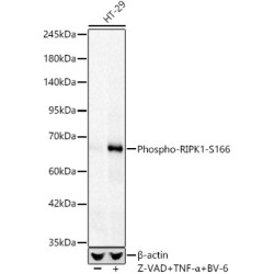 Phospho-RIPK1-S166 Rabbit mAb