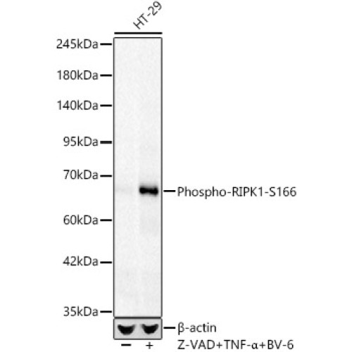 Phospho-RIPK1-S166 Rabbit mAb