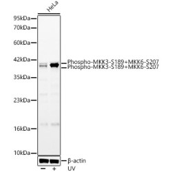 Phospho-MKK3-S189+MKK6-S207 Rabbit mAb