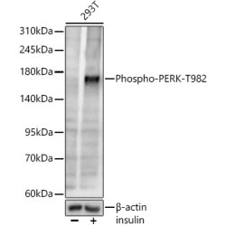 Phospho-PERK-T982 Rabbit mAb