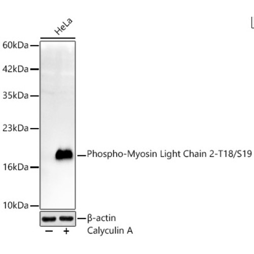 Phospho-Myosin Light Chain 2-T18/S19 Rabbit mAb
