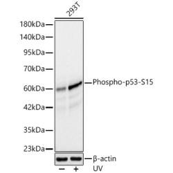 [KO Validated] Phospho-p53-S15 Rabbit mAb