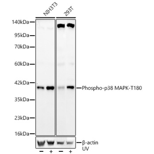 Phospho-p38 MAPK-T180 Rabbit mAb