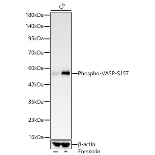 Phospho-VASP-S157 Rabbit mAb