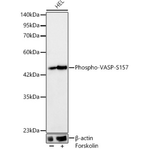 Phospho-VASP-S157 Rabbit mAb