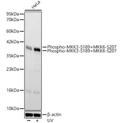 Phospho-MKK3-S189+MKK6-S207 Rabbit mAb