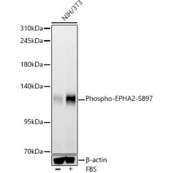 Phospho-EPHA2-S897 Rabbit mAb