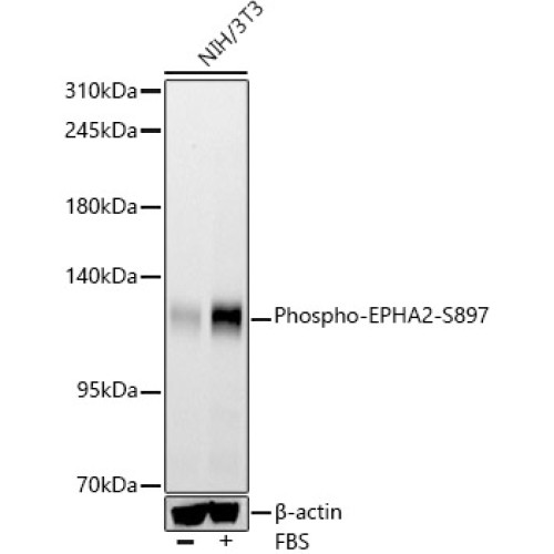 Phospho-EPHA2-S897 Rabbit mAb