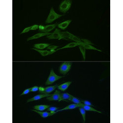 FITC-conjugated Donkey anti-Rabbit IgG (H+L)