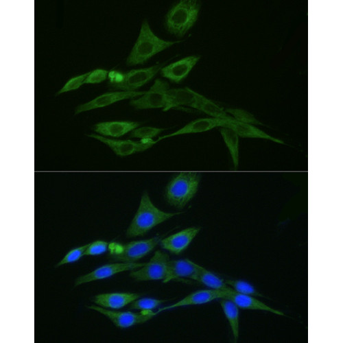 FITC-conjugated Donkey anti-Rabbit IgG (H+L)