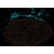 abberior CELLS 2 color, NPC - STAR RED, Golgi - STAR ORANGE