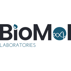 (ACE I/D) INS/DEL polymorfismus  (ACE I/D) INS/DEL polymorfismus